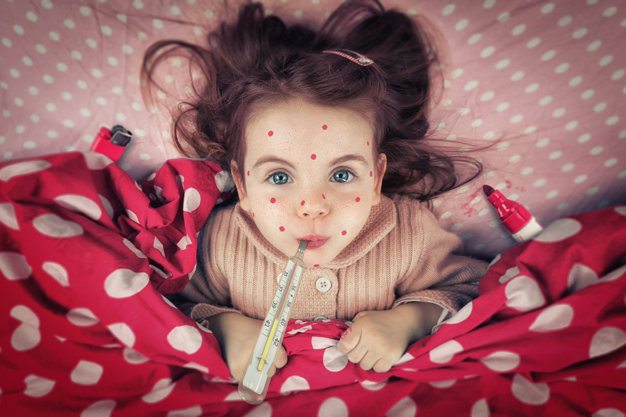 36 випадків кору за тиждень: захворюваність росте майже в геометричній прогресії