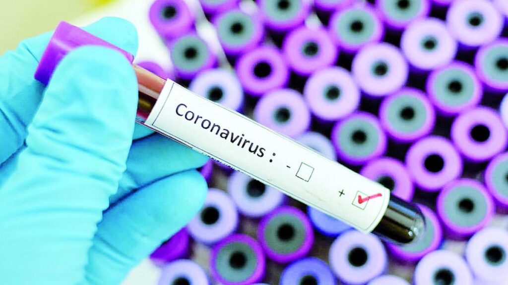 У Броварах і Калиті – нові випадки COVID-19 коронавірус