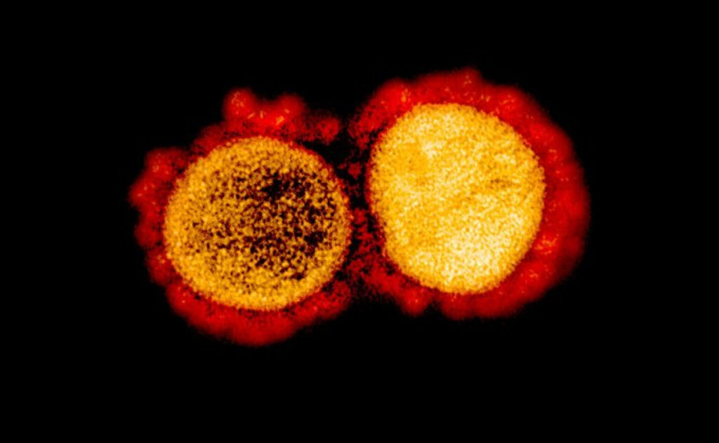 У Бобрику встановили 2 випадки COVID-19. Статистика на Броварщині коронавірус