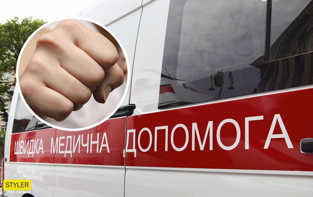 Працівник УДО з Богданівки побив танцівника Дорофеєвої: хлопець у комі. ФОТО