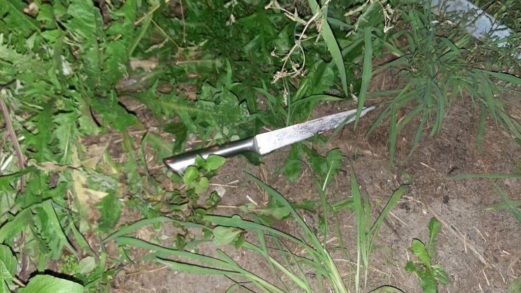 Не дозволив пити з друзями: у Броварах жінка підрізала чоловіка. ФОТО